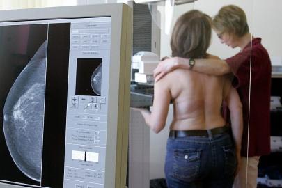 Araştırma: Yapay zeka agresif meme kanserini daha erken saptayabilir