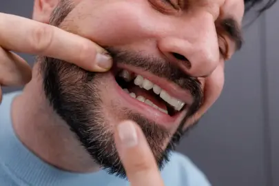 “Nasıl olsa sonra yaptırırım” diyenler dikkat! Diş kaybı zincirleme sağlık sorunlarına yol açıyor