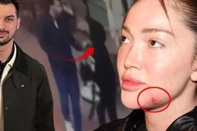 Son dakika... Fenomen Danla Biliç’i darbeden eski sevgilinin cezası belli oldu