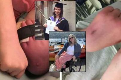 SON DAKİKA HABERLER: Genç yaşta 'intihar hastalığı' teşhisi aldı! Hayatını değiştiren tek bir kıvılcım oldu, ölüde layık görüldü