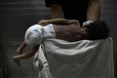 Gazze'de savaşın gölgesinde bebek ölümleri ve doğum kusurları artıyor