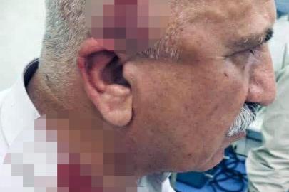 Kerkük'te kaçak yapı yıkımı sırasında kaymakama bıçaklı ve sopalı saldırı