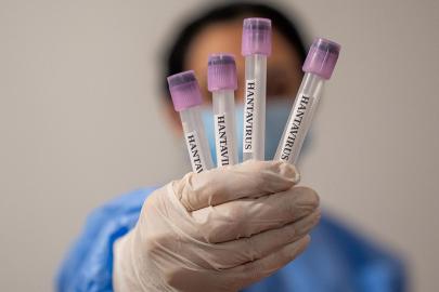 DSÖ'den Hantavirüs açıklaması: Büyük bir salgının başlangıcını gördüğümüze dair bir işaret yok