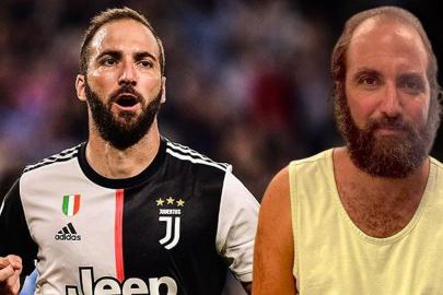 Gonzalo Higuain resmen çöktü! Son hali çok şaşırttı