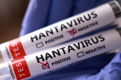 Hantavirüs'de son durum: Birçok ülke vatandaşlarını tahliye için bekliyor